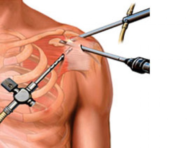 Total, Partial Knee Replacement Surgery Specialist Surgeon in Mumbai | Dr. Amyn Rajani