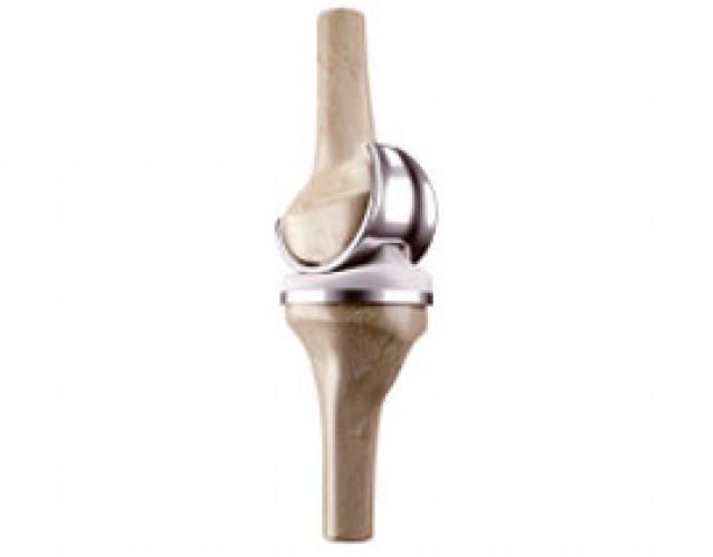 Total, Partial Knee Replacement Surgery Specialist Surgeon in Mumbai | Dr. Amyn Rajani