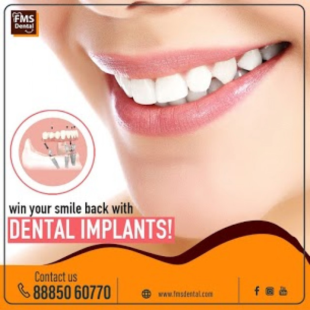 Best Dental Clinic In KPHB | Best Dental Clinic In Kukatpally | Best Dental Clinic In Hyderabad, India-8886643228