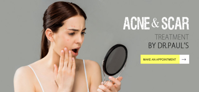 Acne & Scar Treatment in Kolkata