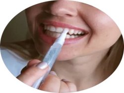 LaserGlow™ Teeth Whitening Kit