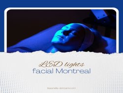 Black Skincare in Montreal
